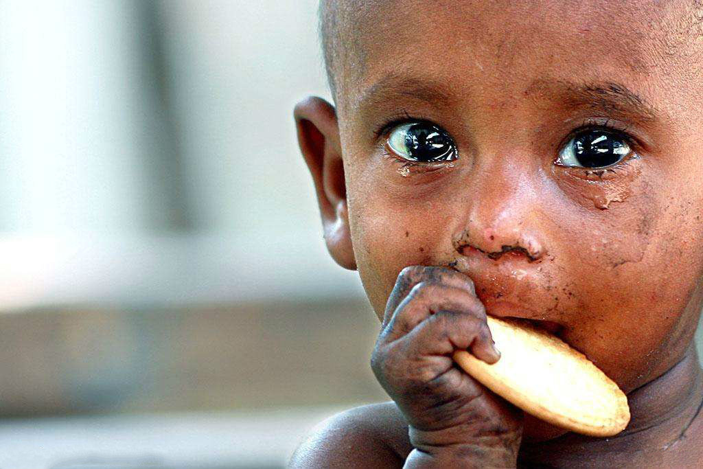 《全球营养报告》：20亿人过于肥胖 至少1.5亿儿童挨饿